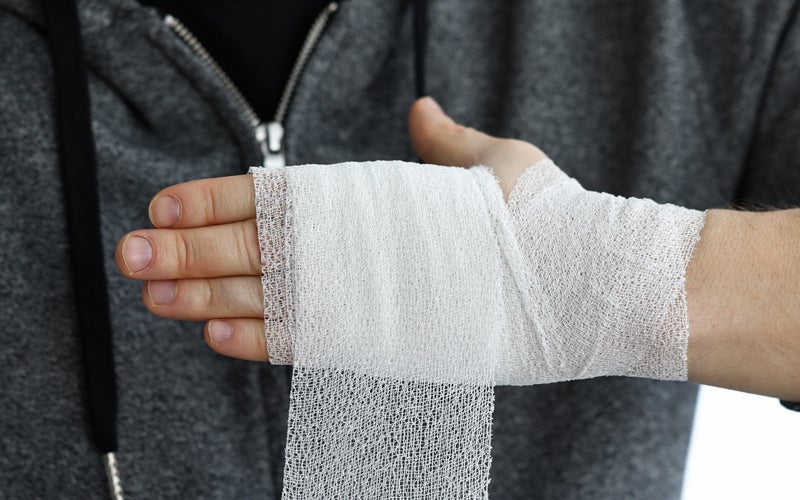 Person wrapping hand after burn injury