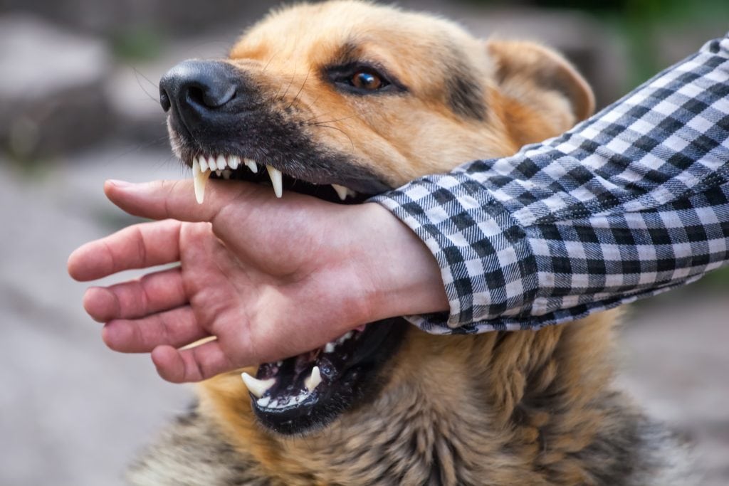Texas Dog Bite Law: What Are Your Rights?